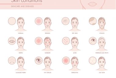What to look for if you have dry skin
